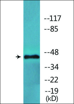 Anti-phospho-GATA1 (pSer¹?²) antibody produced in