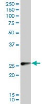 Anti-TPPP antibody produced in mouse