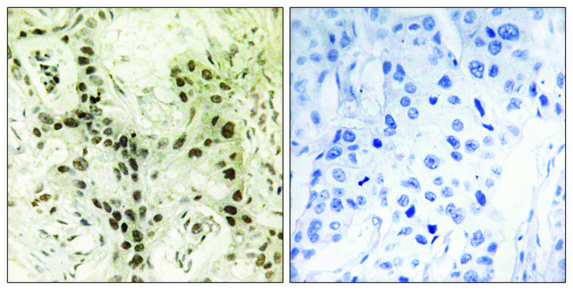 Anti-FOXI1 antibody produced in rabbit