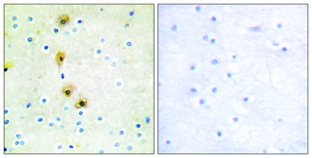 Anti-AKT antibody produced in rabbit