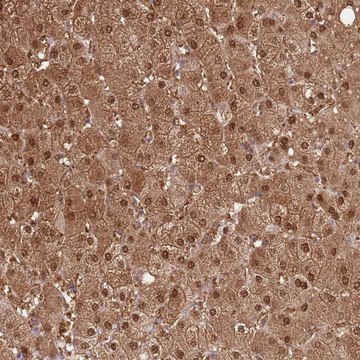 Anti-PLPPR2 antibody produced in rabbit
