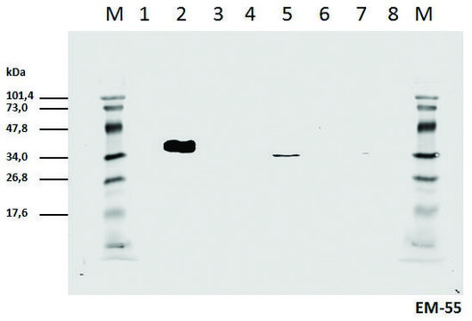 Monoclonal Anti-CD3 zeta (PhosphoTyr111) antibody