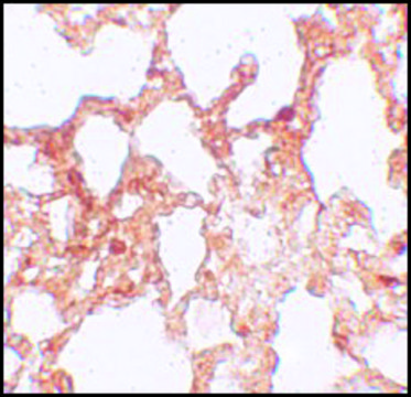 Anti-ZMYM1 antibody produced in rabbit
