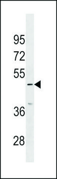 ANTI-IP6K3(N-TERMINAL) antibody produced in rabbit