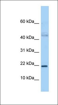 Anti-JDP2 antibody produced in rabbit