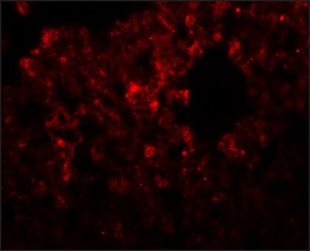 Anti-RHBDD3 antibody produced in rabbit