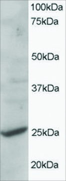 Anti-CYB561D2 antibody produced in goat