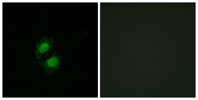 Anti-ZNF95 antibody produced in rabbit