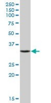 Anti-SULT1E1 antibody produced in mouse