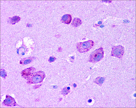Anti-HGF (ab1) antibody produced in