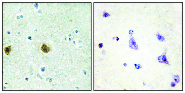 Anti-NDUC2 antibody produced in rabbit