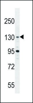 ANTI-GLTSCR1 (CENTER) antibody produced in