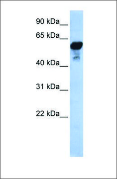 Anti-ALDH1B1 antibody produced in rabbit