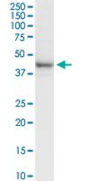 Anti-RRM2 antibody produced in rabbit