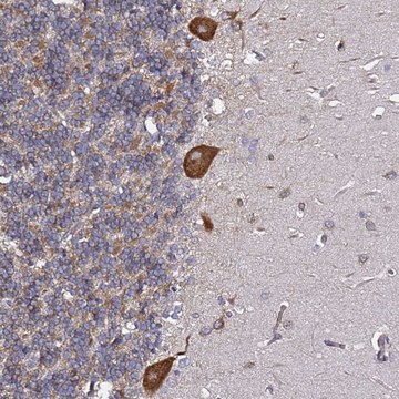 Anti-TPST1 antibody produced in rabbit