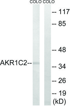 Anti-AKR1C2 antibody produced in rabbit