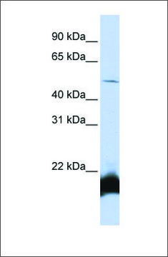 Anti-ONECUT1 (ab1) antibody produced in