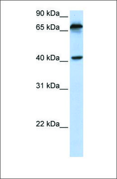 Anti-MICA antibody produced in rabbit