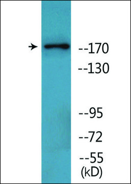 Anti-phospho-TOP2A (pThr¹³?³) antibody produced in