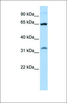 Anti-SLC24A6 antibody produced in rabbit