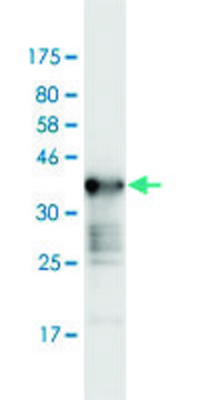 Monoclonal Anti-WNK2, (C-terminal) antibody produced