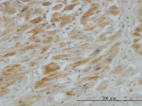 Monoclonal Anti-HHIP antibody produced in