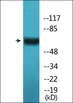 Anti-phospho-Estrogen Receptor-? (pSer¹??) antibody produced
