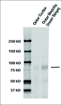Anti-SCNN1A antibody produced in rabbit