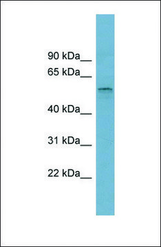 Anti-SLC22A15 antibody produced in rabbit
