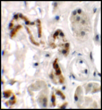 Anti-DBX1 antibody produced in rabbit