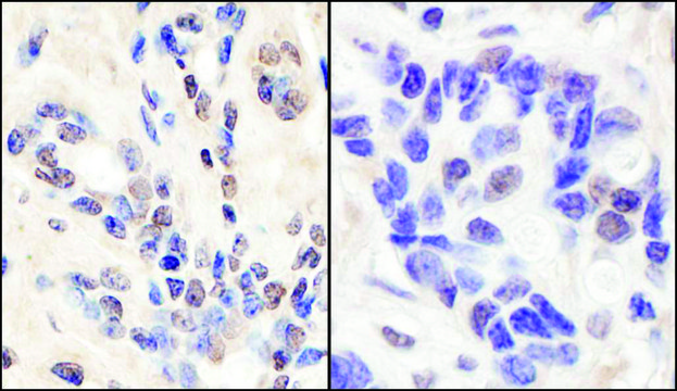 Rabbit anti-BRCA1 Antibody, Affinity Purified