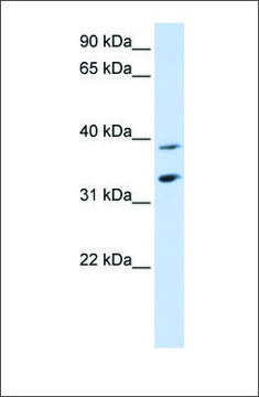 Anti-SLC25A34 antibody produced in rabbit