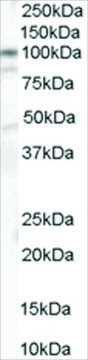 Anti-Catenin ?1 antibody produced in