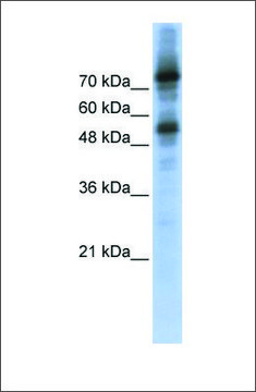 Anti-FOXM1 (ab2) antibody produced in