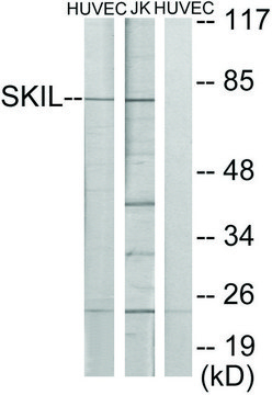 Anti-SKIL antibody produced in rabbit