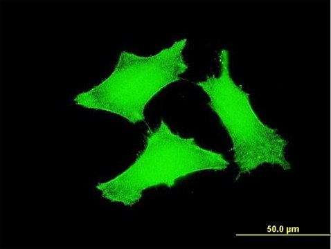 ANTI-TCL1A antibody produced in mouse