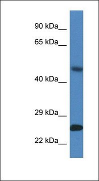 Anti-SNX10 antibody produced in rabbit