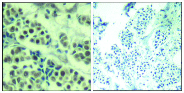Anti-MDM2 (Ab-166) antibody produced in