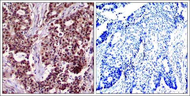 Anti-phospho-NFKB1 (pSer?²?) antibody produced in