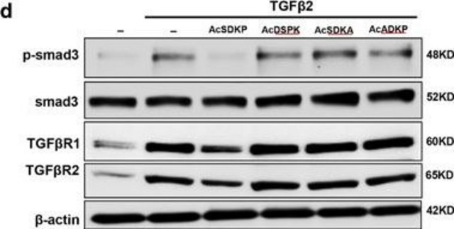 Anti-TGF ? Receptor I antibody