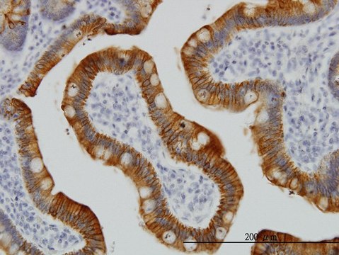Monoclonal Anti-KRT17 antibody produced in