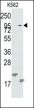 Anti-MIC1 (center) antibody produced in