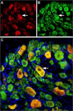 Anti-Sodium Channel ASIC3 antibody produced