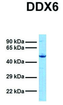 Anti-DDX6 (N-terminal) antibody produced in