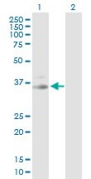 Anti-PRKG1 antibody produced in rabbit