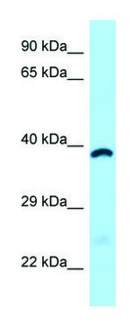 Anti-ABHD6 (C-terminal) antibody produced in