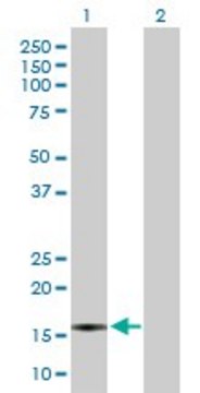 Anti-CXCL5 antibody produced in rabbit