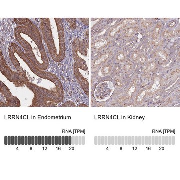 Anti-LRRN4CL antibody produced in rabbit
