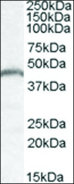 Anti-PNPLA3 antibody produced in goat
