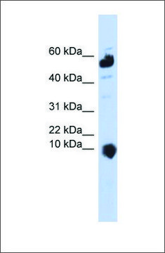Anti-C1ORF151 antibody produced in rabbit